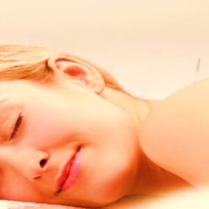 Acupuntura Estética