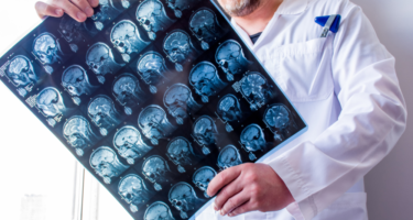 Radiologia Básica em Neuroimagem